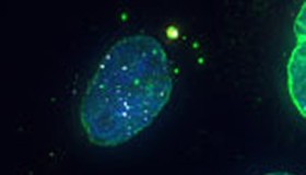 Novo "miniórgão" é descoberto em células de mamíferos; entenda importância