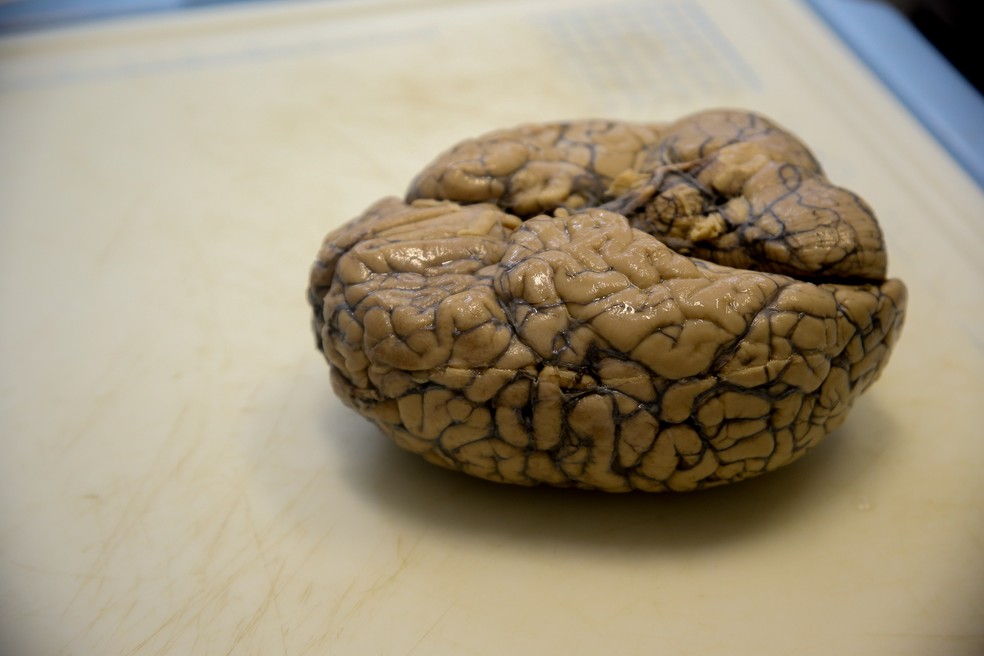 Ao redor de todo o cérebro é possível observar dobras de diferentes grossuras — Foto: Cecília Bastos/USP Imagens