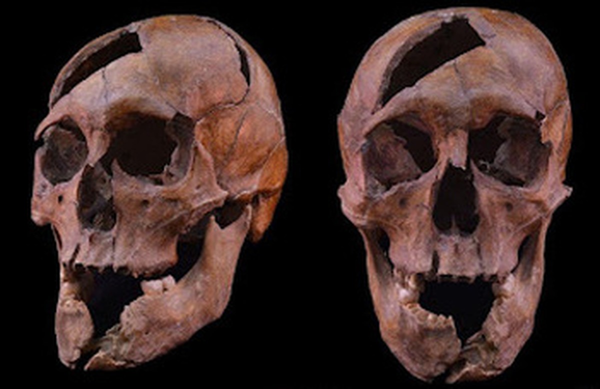 DNA ajuda a desvendar assassinato medieval de duque húngaro morto há 700 anos