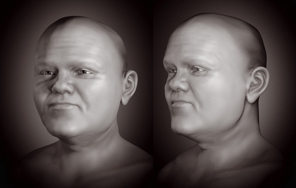 Aproximação facial do homem medieval com nanismo sem cabelo e barba — Foto: Moraes et al