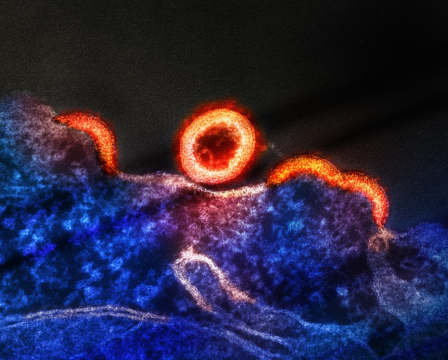 Micrografia eletrônica de transmissão de partículas do vírus HIV-1 (coloridas em vermelho/laranja) replicando a partir de uma célula T H9 infectada pelo HIV (azul/roxo)