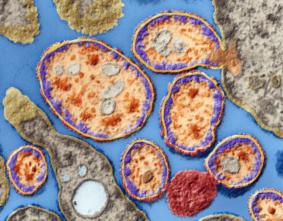 Vírus de sarampo e estomatite foram utilizados para tratar o câncer de mama de cientista — Foto: Eye Of Science/Science Photo Library