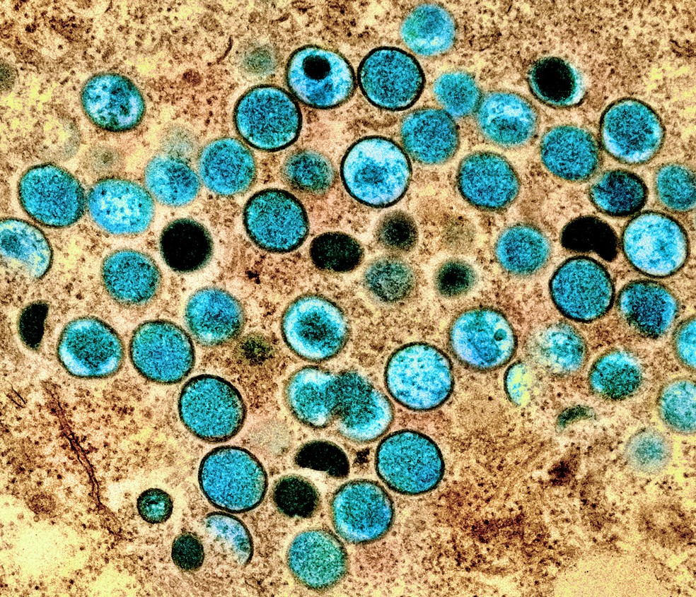 Micrografia eletrónica de transmissão de partículas de vírus da varíola dos macacos (a verde), observadas numa célula infetada (a castanho) — Foto: NIAID