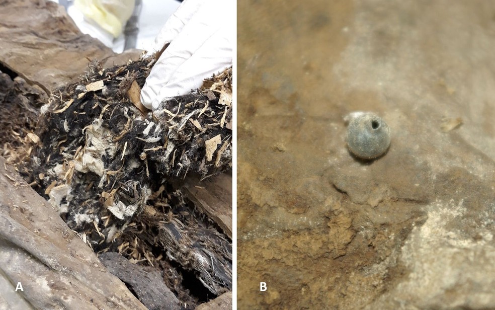 Esquerda: A remoção de partes do material estranho da parede abdominal dorsal revelou uma mistura de tecido branco fragmentado, pequenas lascas de madeira e material vegetal, juntamente com alguns resíduos de tecido amorfo acastanhado. Direita: A esfera estranha redonda detectada na pelve esquerda apresentava um pequeno orifício com uma borda elevada — Foto: Andreas Nerlich