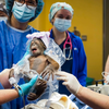 Filhote de orangotango criticamente ameaçado nasce de cesária nos EUA