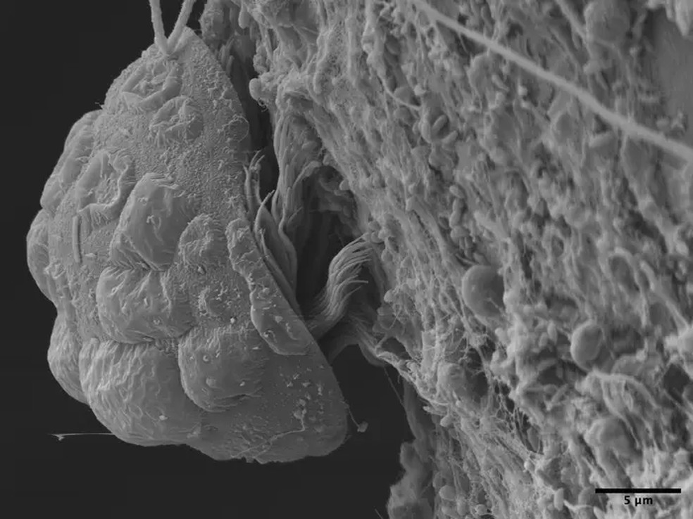 Um parasita protista que vive em Tanystylum kiixin — Foto: Cormac Toler-Scott