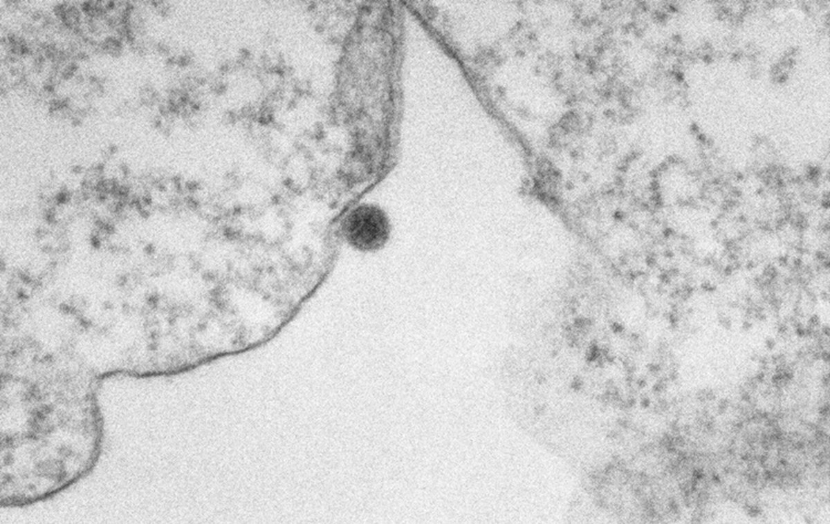 Cientistas brasileiros captam imagens inéditas do vírus Oropouche em ação