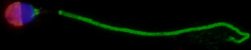 Microscopia de imunofluorescência de células espermáticas e tecidos testiculares. AKAP4 é mostrado em verde, ASPX em vermelho e núcleos celulares em azul — Foto: ZHANG ET AL., MOLECULAR & CELLULAR PROTEOMICS