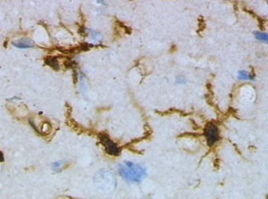 Em camundongos, foi observado que a micróglia, um tipo de célula imunológica do sistema nervoso que compõe a chamada glia – conjunto diversificado de células que dá suporte ao funcionamento dos neurônios – pode limitar a perda de capacidade motora e a morte neurona