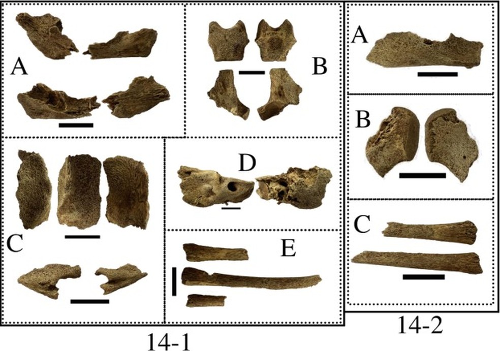 Formação óssea patológica e aumento da porosidade identificados nos indivíduos gêmeos — Foto: Anna Osterholtz et al.