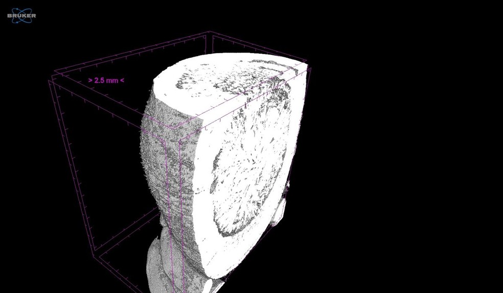 Uma imagem microCT que mostra a estrutura da vesícula biliar de porcelana preservada e o cálculo biliar dentro dela — Foto: Departamento de Ciência de Materiais Biomédicos, UMMC