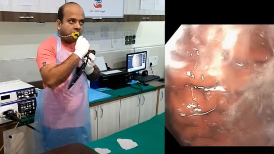Médico faz endoscopia nele mesmo e vídeo viraliza; assista
