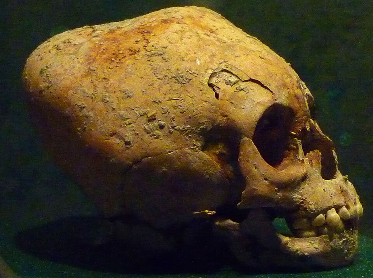 Crânio quadrado no México revela antiga prática de deformação intencional