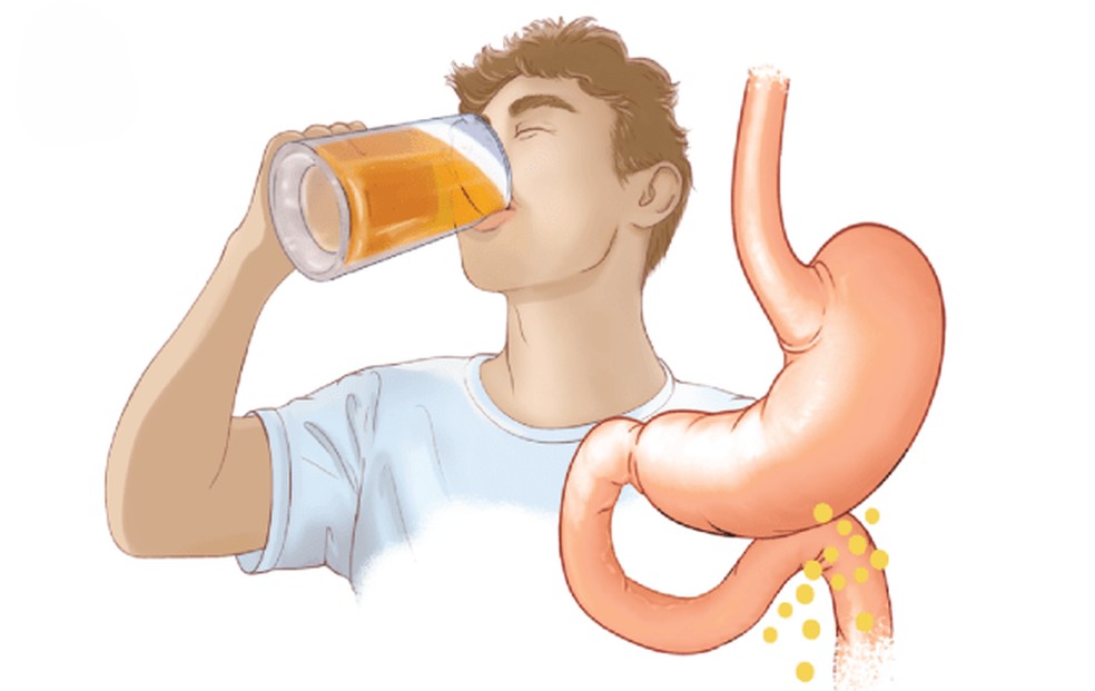 O fermento vivo presente na cerveja pode transportar partículas semelhantes a vírus através do estômago até os intestinos, onde o fermento se rompe para liberar seu conteúdo. — Foto: Hrejsa