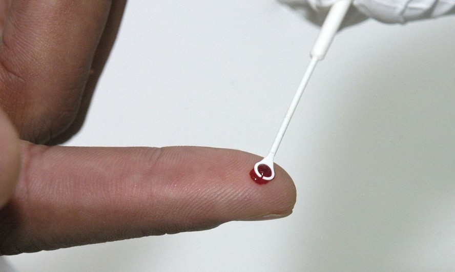 Coleta de sangue para teste rápido de HIV