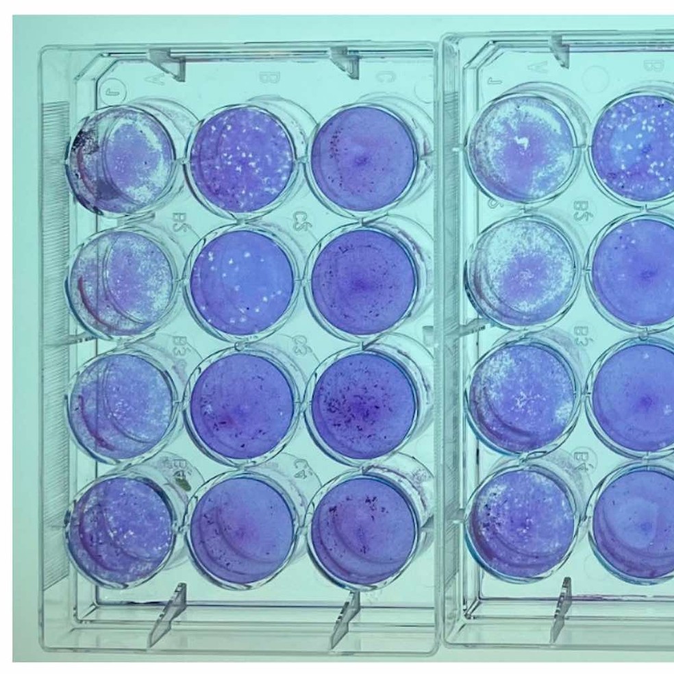Ensaio de placa GRJV1 em células contaminadas — Foto: DeRuyter et al.