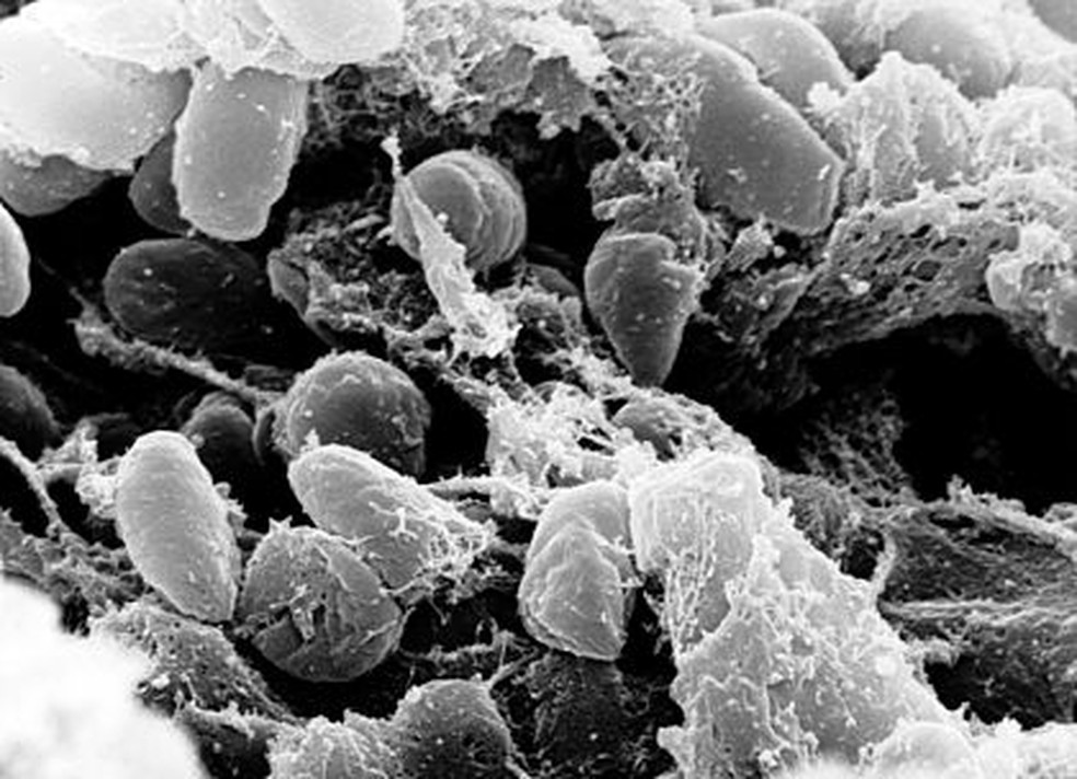 Imagens da bácteria Yersinia pestis — Foto: Wikipédia