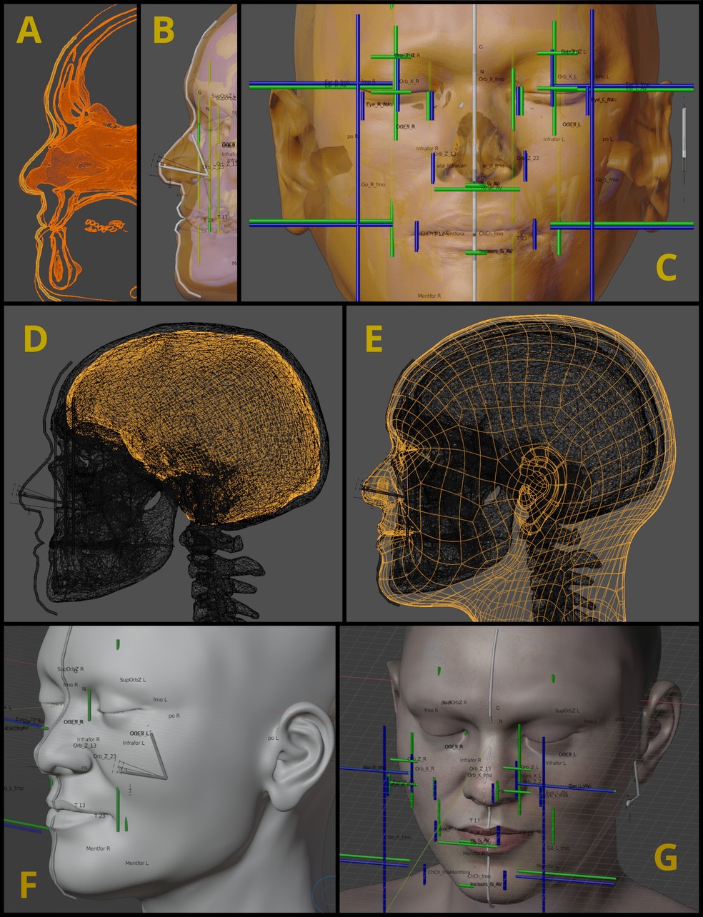 Etapas da aproximação facial digital da mulher de 45 mil anos  — Foto: Cicero Moraes et.al 